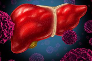 Of 25 patients, hepatitis C virus disease transmission occurred in 4 recipients. Of 25 patients, hepatitis C virus disease transmission occurred in 4 recipients.