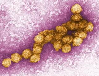 West Nile virus patients showed significant thinning in both the left and right hemispheres, mainly in the frontal and limbic lobes. <i>Photo Credit: Cynthia Goldsmith.</i> West Nile virus patients showed significant thinning in both the left and right hemispheres, mainly in the frontal and limbic lobes. <i>Photo Credit: Cynthia Goldsmith.</i>
