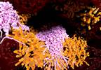 Sulfonylureas May Increase Tuberculosis Risk in Type 2 Diabetes Sulfonylureas May Increase Tuberculosis Risk in Type 2 Diabetes