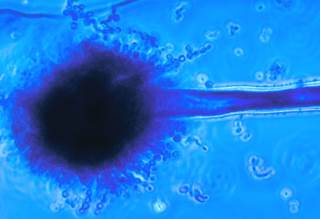<i>Aspergillus flavus</i> is the second most frequent species causing invasive aspergillosis and is the leading cause of acute invasive fungal sinusitis. <i>Photo Credit: CDC/Dr Libero Ajello.</i> <i>Aspergillus flavus</i> is the second most frequent species causing invasive aspergillosis and is the leading cause of acute invasive fungal sinusitis. <i>Photo Credit: CDC/Dr Libero Ajello.</i>