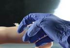 Efficacy of 9-Valent HPV Vaccine in Young Women Efficacy of 9-Valent HPV Vaccine in Young Women