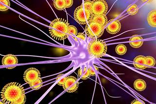 Among a total of 47 potential case patients who were enrolled, a diagnosis of GBS was confirmed in 39. Among a total of 47 potential case patients who were enrolled, a diagnosis of GBS was confirmed in 39.