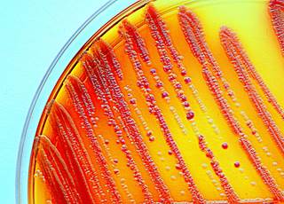 Follow-up blood cultures should be considered a crucial tool in the management of septic thrombophlebitis. Follow-up blood cultures should be considered a crucial tool in the management of septic thrombophlebitis.