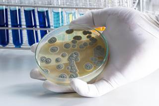 This could potentially lead to pneumonia, sinusitis and disseminated infections. This could potentially lead to pneumonia, sinusitis and disseminated infections.