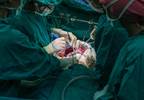 Antibiotics, Mechanical Bowel Preparation Associated With Reduced SSIs Antibiotics, Mechanical Bowel Preparation Associated With Reduced SSIs