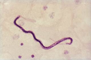 LoaScope is a field-friendly diagnostic tool that automatically counts <i>L loa</i> microfilariae in peripheral blood. <i>Photo Credit: Biophoto Associates/Science Source.</i> LoaScope is a field-friendly diagnostic tool that automatically counts <i>L loa</i> microfilariae in peripheral blood. <i>Photo Credit: Biophoto Associates/Science Source.</i>
