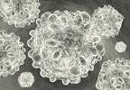 SVR Achieved With Sofosbuvir, Grazoprevir/Elbasvir Plus Ribavirin in HCV SVR Achieved With Sofosbuvir, Grazoprevir/Elbasvir Plus Ribavirin in HCV