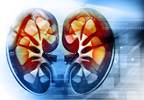 Flu-Like Illness Tied to Increased Relative Mortality in ESRD Flu-Like Illness Tied to Increased Relative Mortality in ESRD