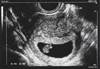 Reproductive Recourse: Why Are Reproductive Malpractice Claims So Challenging? Reproductive Recourse: Why Are Reproductive Malpractice Claims So Challenging?