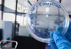 Fosfomycin Tops Fluoroquinolones for Prostate Biopsy Prophylaxis Fosfomycin Tops Fluoroquinolones for Prostate Biopsy Prophylaxis