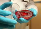 CDC: Aggressive Action Needed to Contain Antibiotic Resistance CDC: Aggressive Action Needed to Contain Antibiotic Resistance