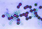 Delaying Rotavirus Vaccination Until Discharge Leads to Missed Opportunities Delaying Rotavirus Vaccination Until Discharge Leads to Missed Opportunities