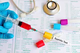 Women with an STI coinfection were almost twice as likely to have an HIV-infected infant. Women with an STI coinfection were almost twice as likely to have an HIV-infected infant.