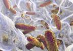 Ceftazidime-Avibactam Efficacious in Nosocomial Pneumonia Ceftazidime-Avibactam Efficacious in Nosocomial Pneumonia