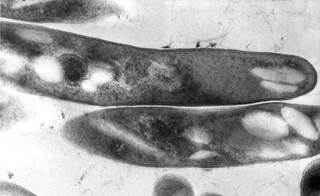 Mortality was higher in patients whose CD4 was persistently ≤100 cells/mm<sup>3</sup>. <i>Photo Credit: CDC/ Elizabeth "Libby" White.</i> Mortality was higher in patients whose CD4 was persistently ≤100 cells/mm<sup>3</sup>. <i>Photo Credit: CDC/ Elizabeth "Libby" White.</i>