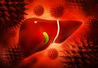 CDC: Proportion of Increased-Risk Deceased Organ Donors on Rise CDC: Proportion of Increased-Risk Deceased Organ Donors on Rise