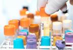 Cardiovascular Medication Adherence Effectively Tracked With New Test Cardiovascular Medication Adherence Effectively Tracked With New Test