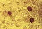 Chlamydia Infection Not Associated With Adverse Birth Outcomes Chlamydia Infection Not Associated With Adverse Birth Outcomes