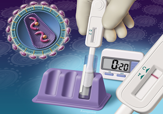 Of 214,524 patients tested, 839 received a new diagnosis of HIV, including 122 patients with acute HIV infection. <i>Photo Credit: John Karapelou.</i> Of 214,524 patients tested, 839 received a new diagnosis of HIV, including 122 patients with acute HIV infection. <i>Photo Credit: John Karapelou.</i>