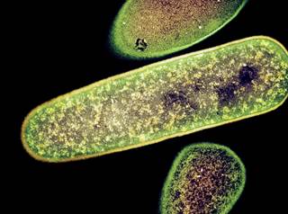 Antibiotics vancomycin or fidaxomicin should be used for initial treatment of even mild <i>C difficile</i> rather than metronidazole. <i>Photo Credit: Dr Kari Lounatmaa/Science Source.</i> Antibiotics vancomycin or fidaxomicin should be used for initial treatment of even mild <i>C difficile</i> rather than metronidazole. <i>Photo Credit: Dr Kari Lounatmaa/Science Source.</i>