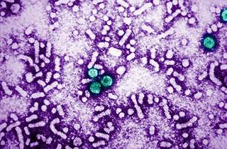 Clinics using the voluntary electronic medical record order check increased HBV testing rates to 93%-98% and HBV antiviral prophylaxis rates to 99%. Clinics using the voluntary electronic medical record order check increased HBV testing rates to 93%-98% and HBV antiviral prophylaxis rates to 99%.