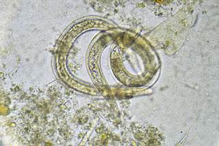 <i>S stercoralis</i> DNA was detected by polymerase chain reaction in all stool samples from all patients. <i>S stercoralis</i> DNA was detected by polymerase chain reaction in all stool samples from all patients.