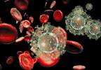 Greater Temporal Summation of Pain in HIV With Chronic Pain Greater Temporal Summation of Pain in HIV With Chronic Pain