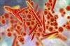 Mycoplasma Pneumonia Increases Risk for Rheumatoid Arthritis Mycoplasma Pneumonia Increases Risk for Rheumatoid Arthritis