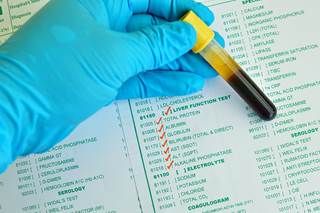 Researchers found that liver-related mortality increases in patients with chronic hepatitis B with relatively mild increases in serum ALT. Researchers found that liver-related mortality increases in patients with chronic hepatitis B with relatively mild increases in serum ALT.
