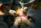 Managing HBV Infection Following Liver Transplant: Expert Q&A Managing HBV Infection Following Liver Transplant: Expert Q&A