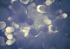 Effectiveness of Meropenem-Vaborbactam for Complicated UTI Treatment Effectiveness of Meropenem-Vaborbactam for Complicated UTI Treatment