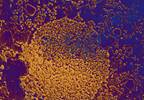 High Concentrations of Key Vaginal Bacteria May Increase Risk for HIV Acquisition High Concentrations of Key Vaginal Bacteria May Increase Risk for HIV Acquisition