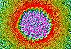 Prevalence of HPV16 High Among HIV-Positive Men Having Sex With Men Prevalence of HPV16 High Among HIV-Positive Men Having Sex With Men