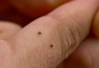 Major Advances on Horizon for Tick-Borne Disease Testing Major Advances on Horizon for Tick-Borne Disease Testing