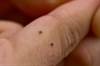 Major Advances on Horizon for Tick-Borne Disease Testing Major Advances on Horizon for Tick-Borne Disease Testing