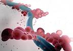 T2Candida May Shorten Time to Candida Detection, Species Identification T2Candida May Shorten Time to Candida Detection, Species Identification