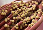 Practices Vary in Treating Adult <i>Staphylococcus aureus</i> Bacteremia Practices Vary in Treating Adult <i>Staphylococcus aureus</i> Bacteremia