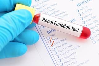 The triple direct-acting antiviral regimen of ombitasvir, paritaprevir plus ritonavir, and dasabuvir had a good renal safety profile in patients with HIV/HCV coinfection. The triple direct-acting antiviral regimen of ombitasvir, paritaprevir plus ritonavir, and dasabuvir had a good renal safety profile in patients with HIV/HCV coinfection.