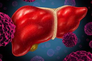 Survival following liver transplantation has improved with the availability of direct-acting antiviral agents. Survival following liver transplantation has improved with the availability of direct-acting antiviral agents.