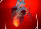 The Uncertain Association Between Abacavir and the Risk for Acute Myocardial Infarction The Uncertain Association Between Abacavir and the Risk for Acute Myocardial Infarction