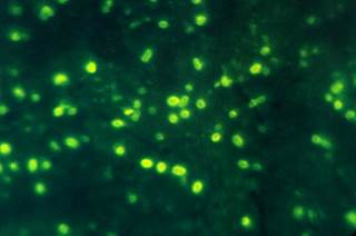 Measurement of serum bactericidal activity is believed to be a more reliable predictor of successful immunization against <i>H influenzae</i> type b. <i>Photo Credit: CDC.</i> Measurement of serum bactericidal activity is believed to be a more reliable predictor of successful immunization against <i>H influenzae</i> type b. <i>Photo Credit: CDC.</i>
