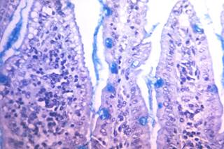 Efficacy did not appear to wane during the trial among adult vaccines. <i>Photo Credit: CDC.</i> Efficacy did not appear to wane during the trial among adult vaccines. <i>Photo Credit: CDC.</i>