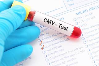 Changes in immune response mediated by cytomegalovirus infection may contribute to compromised neurocognitive performance in adults with HIV. Changes in immune response mediated by cytomegalovirus infection may contribute to compromised neurocognitive performance in adults with HIV.