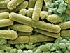 <i>Clostridium difficile</i> Infection in the Intensive Care Setting <i>Clostridium difficile</i> Infection in the Intensive Care Setting