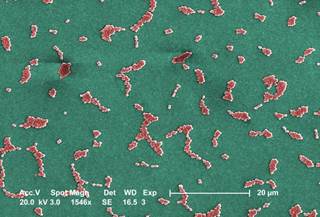 Combination therapy increased the incidence of diarrhea and decreased the incidence of mild renal failure. <i>Photo Credit: CDC/ Janice Haney Carr.</i> Combination therapy increased the incidence of diarrhea and decreased the incidence of mild renal failure. <i>Photo Credit: CDC/ Janice Haney Carr.</i>