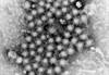 Chronic Hepatitis B Increases Liver-Related Mortality in Acute Hepatitis E Infection Chronic Hepatitis B Increases Liver-Related Mortality in Acute Hepatitis E Infection