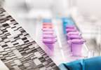 mRNA Assay Less Sensitive Than DNA Assay for Latent HPV mRNA Assay Less Sensitive Than DNA Assay for Latent HPV