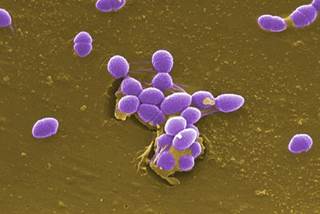 Although ampicillin plus ceftriaxone has emerged as a preferred treatment option, mortality rates continue to be high. <i>Photo Credit: CDC/ Pete Wardell.</i> Although ampicillin plus ceftriaxone has emerged as a preferred treatment option, mortality rates continue to be high. <i>Photo Credit: CDC/ Pete Wardell.</i>