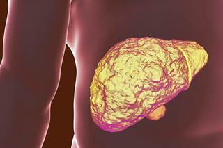 Selective serotonin reuptake inhibitors were not associated with a reduction in risk for cirrhosis. Selective serotonin reuptake inhibitors were not associated with a reduction in risk for cirrhosis.