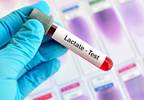 Delays in Lactate Testing Associated With Delayed Antibiotics, Increased Mortality in Sepsis Delays in Lactate Testing Associated With Delayed Antibiotics, Increased Mortality in Sepsis